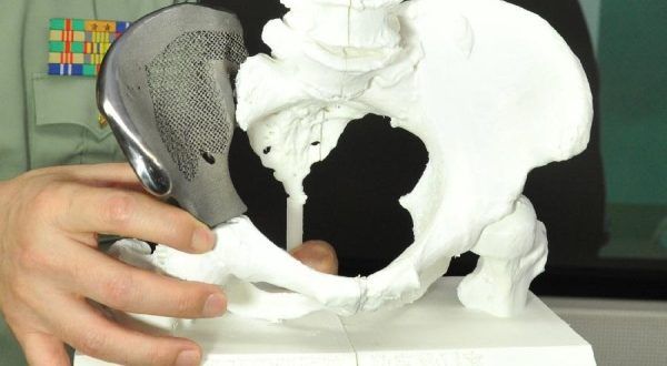 Desarrollan tecnología para fabricar huesos artificiales