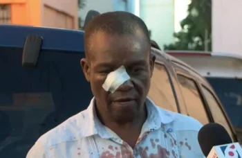 Dos estudiantes agreden a un prefesor del liceo Juan Pablo Duarte